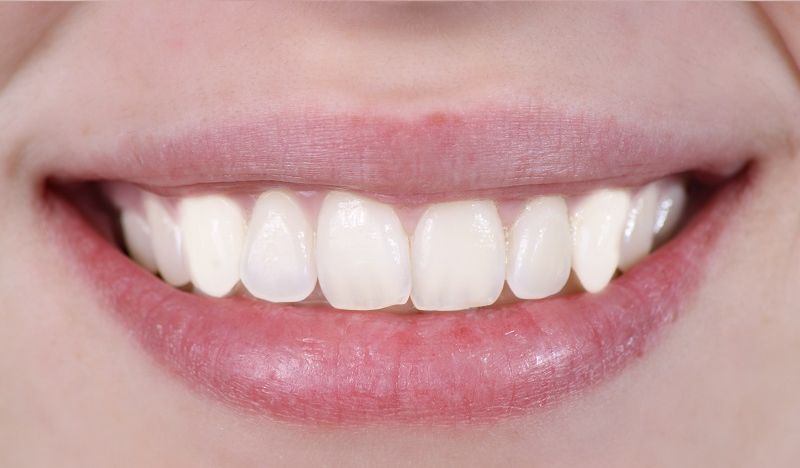 Before,And,After,Dental,Treatment