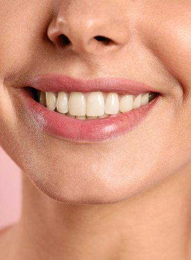 Smiling,Woman,Before,And,After,Teeth,Whitening,Procedure,,Closeup